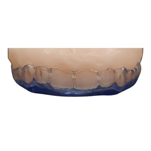FÉRULAS DENTALES DE DESCARGA MIXTA DE LABORATORIO PEÑA DENTAL