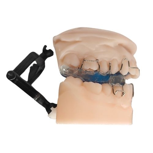 TWIN BLOCK. APARATO FUNCIONAL DE ORTODONCIA DEL LABORATORIO PEÑA DENTAL
